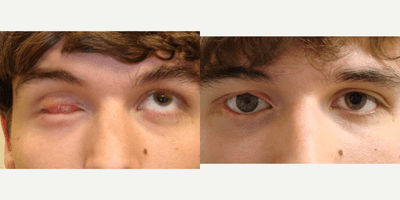 Case 11738 - Facial Reconstructive Surgery