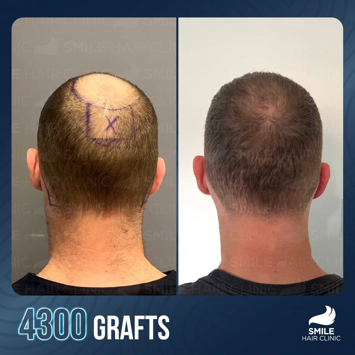 Case 12285 - result