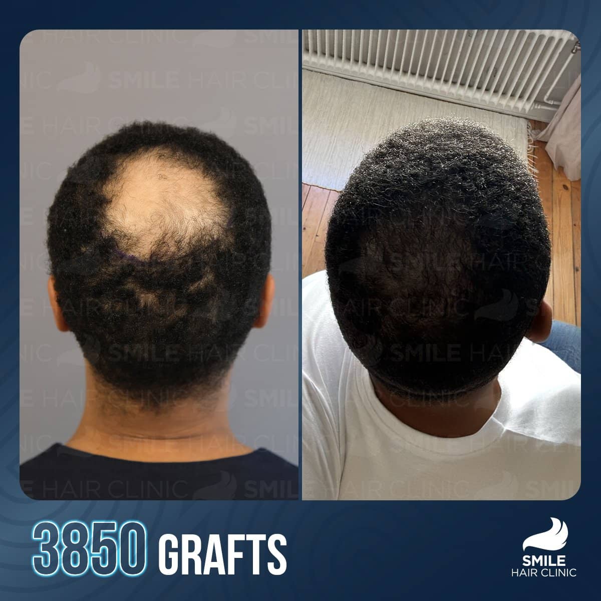 Case 12288 - before and after