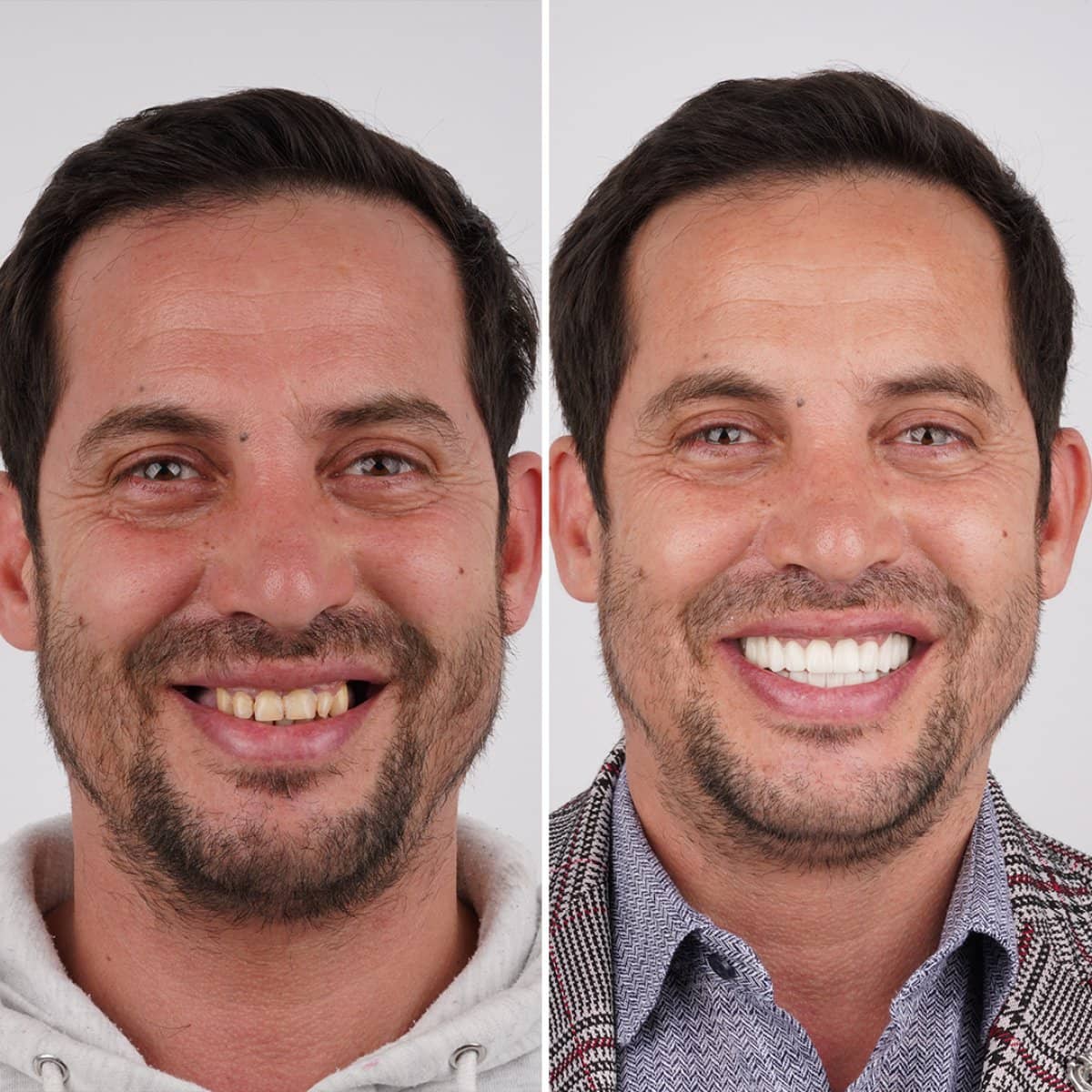Case 12289 - Hollywood Smile