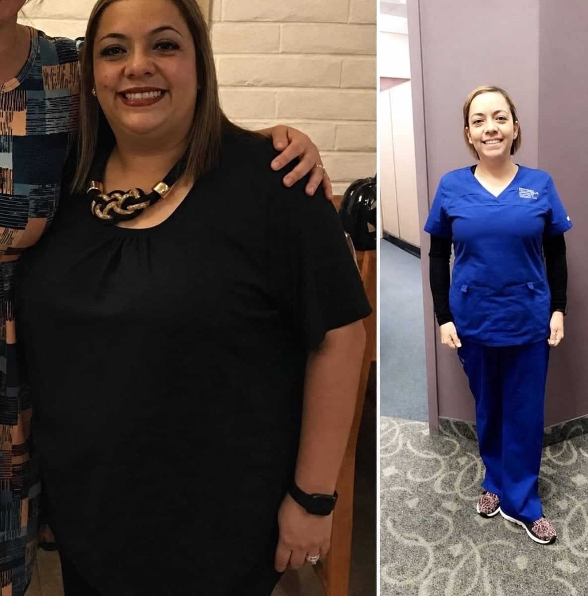 Case 12311 - gastric sleeve surgery