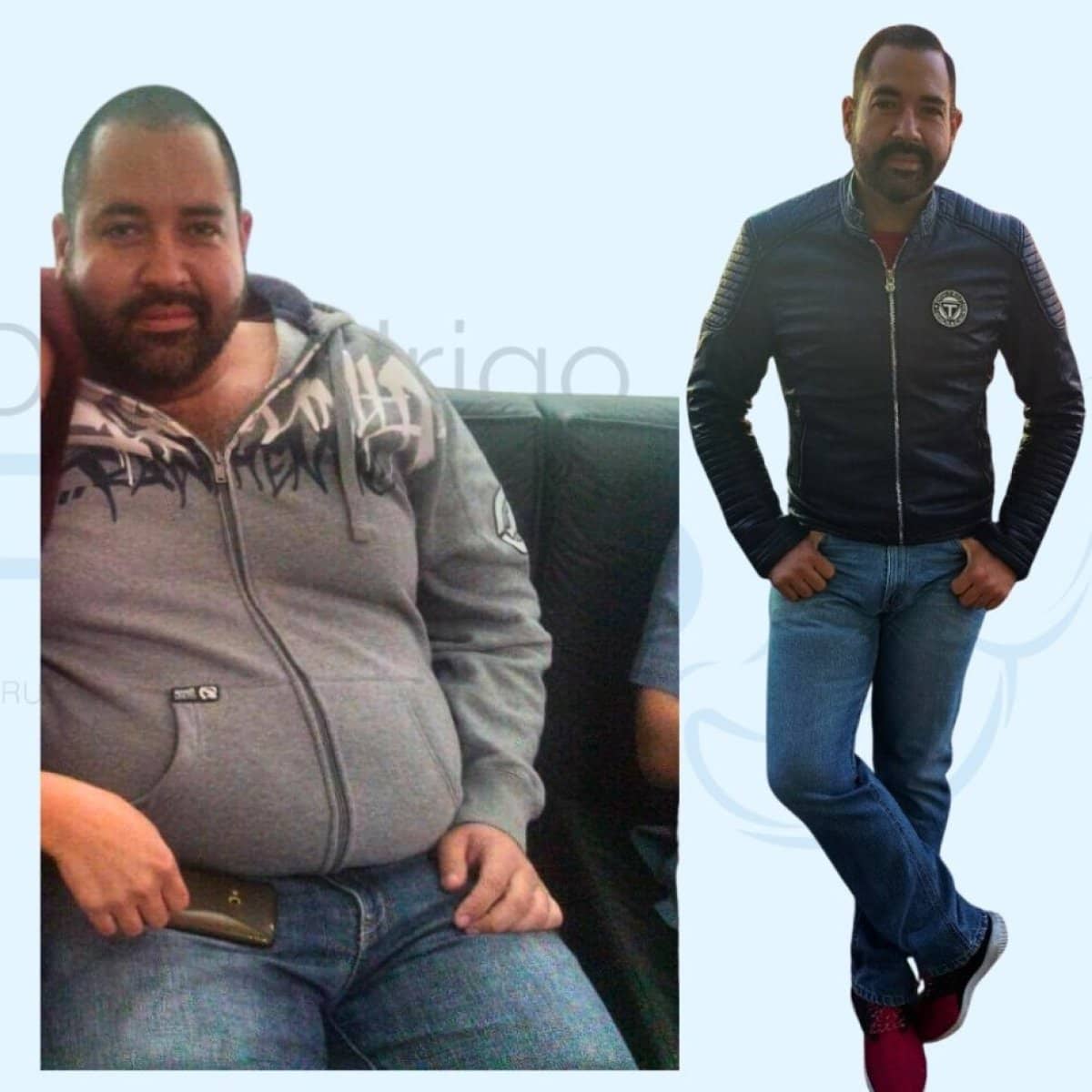 Case 12403 - gastric bypass