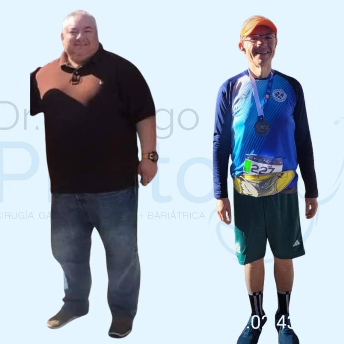 Case 12409 - gastric sleeve surgery