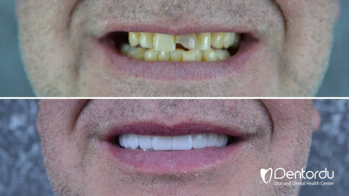 Case 13343 - Hollywood Smile