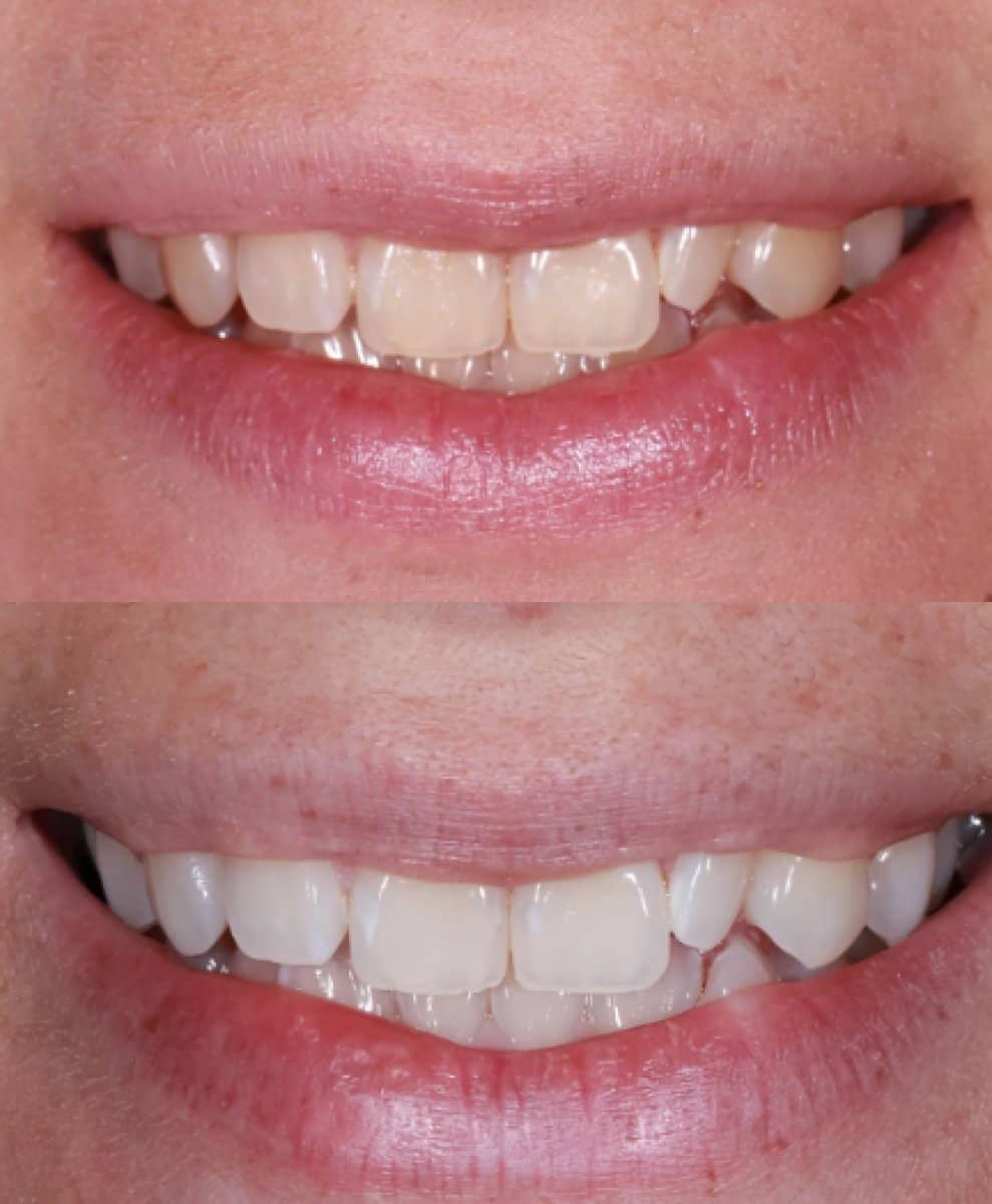 Case 13634 - teeth cleaning (scaling)
