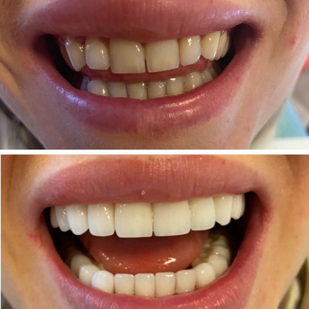 Case 13862 - Hollywood Smile