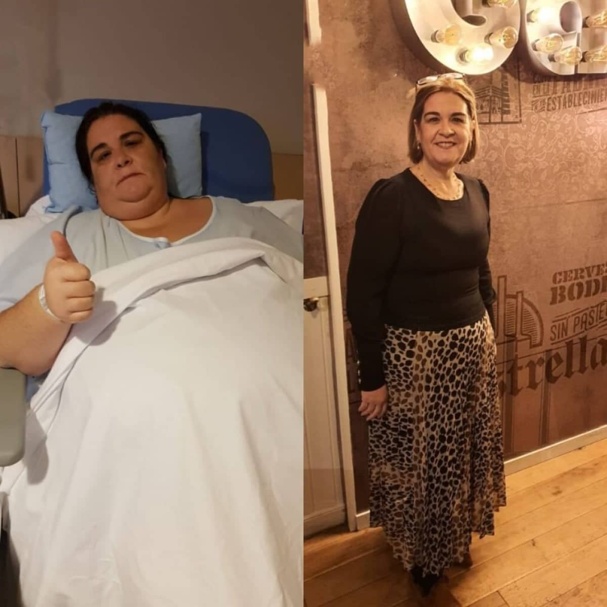 Case 14356 - gastric band