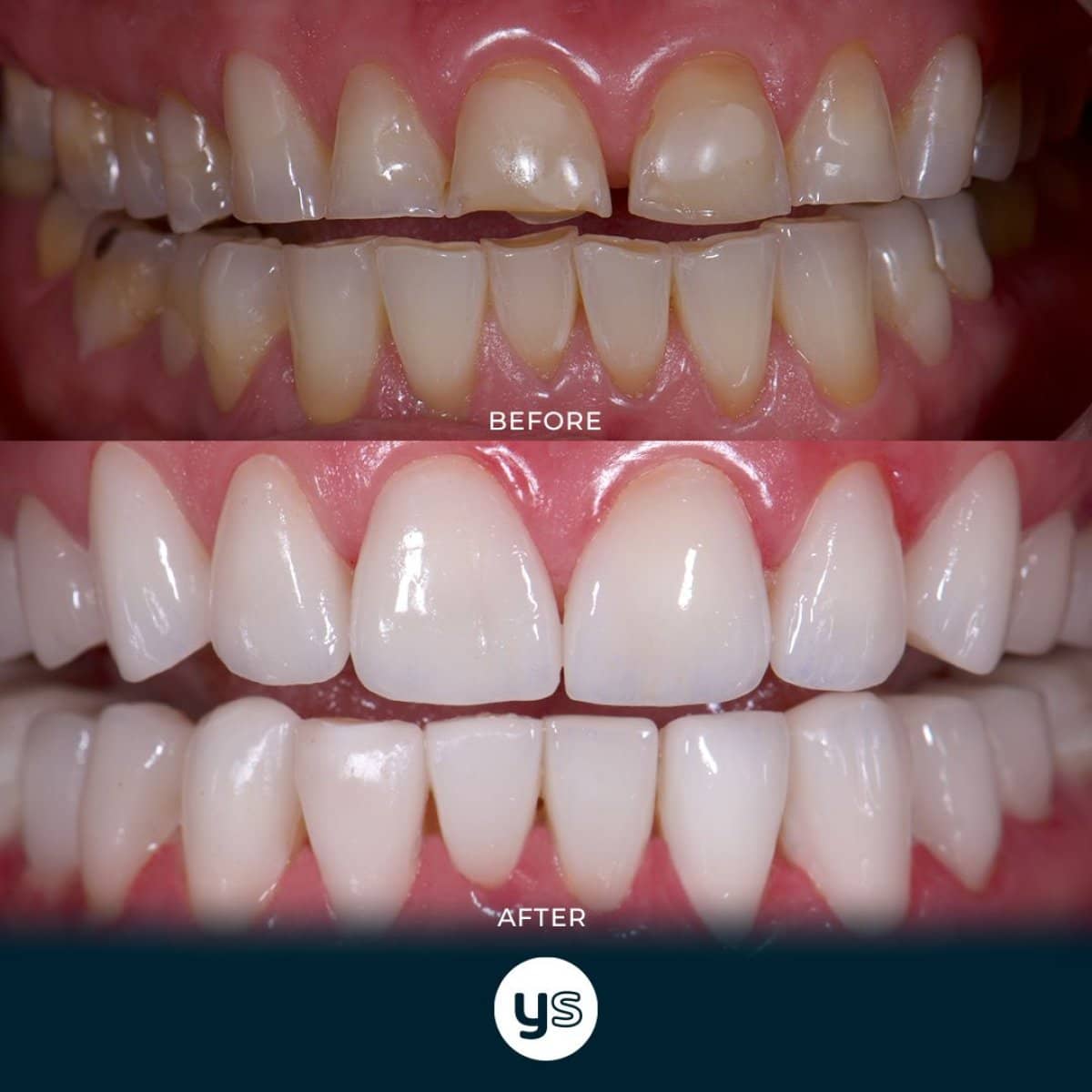 Case 14620 - gum surgery
