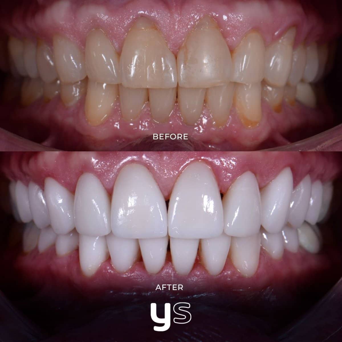 Case 14621 - gum surgery