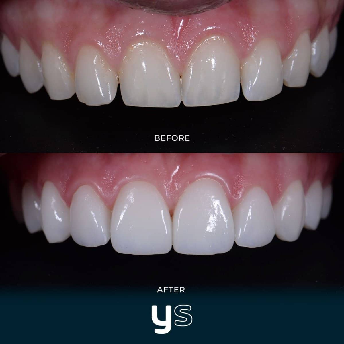 Case 14622 - gum surgery