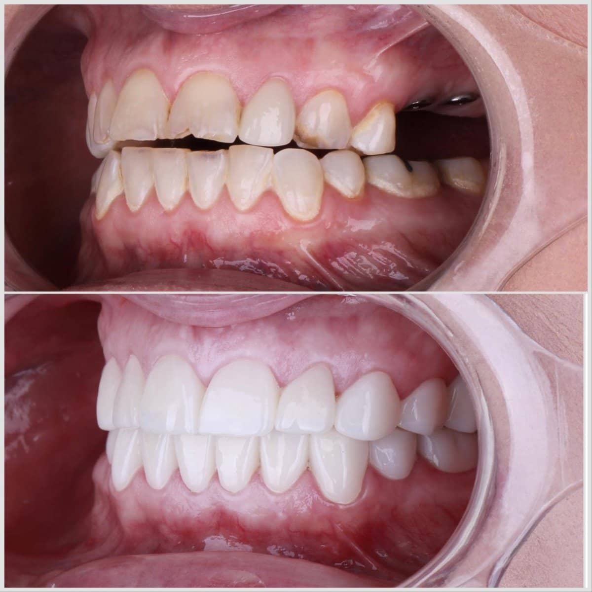 Case 14681 - results