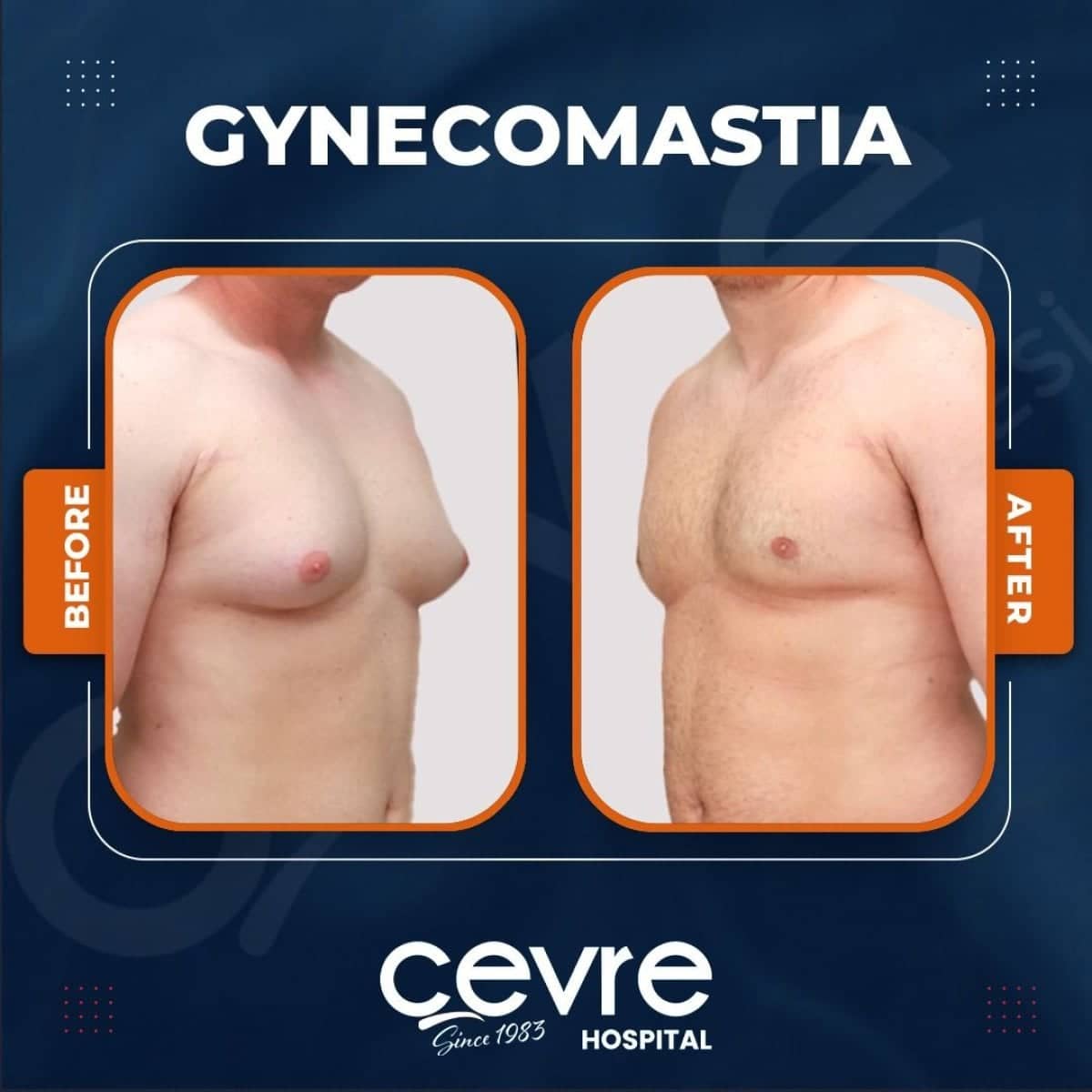 Case 14927 - results