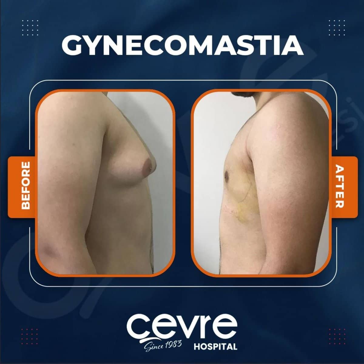 Case 14938 - results
