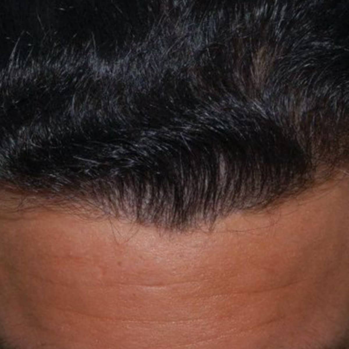 Case 15114 - before and after