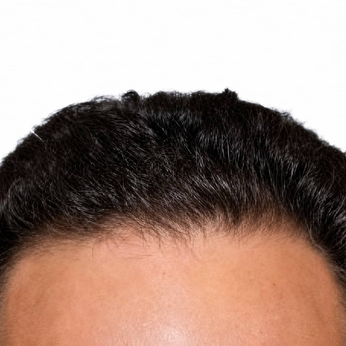 Case 15121 - before and after