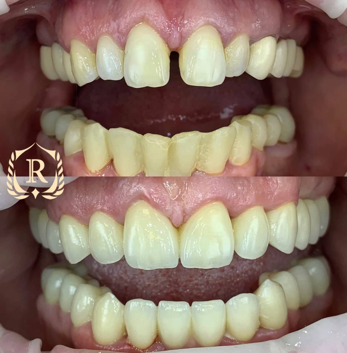 Case 15198 - smile makeover
