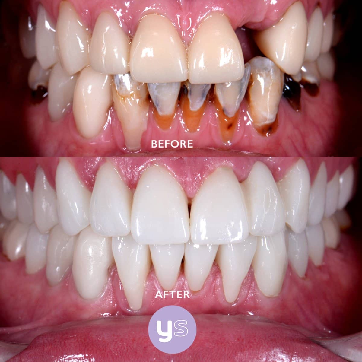 Case 15242 - gum surgery