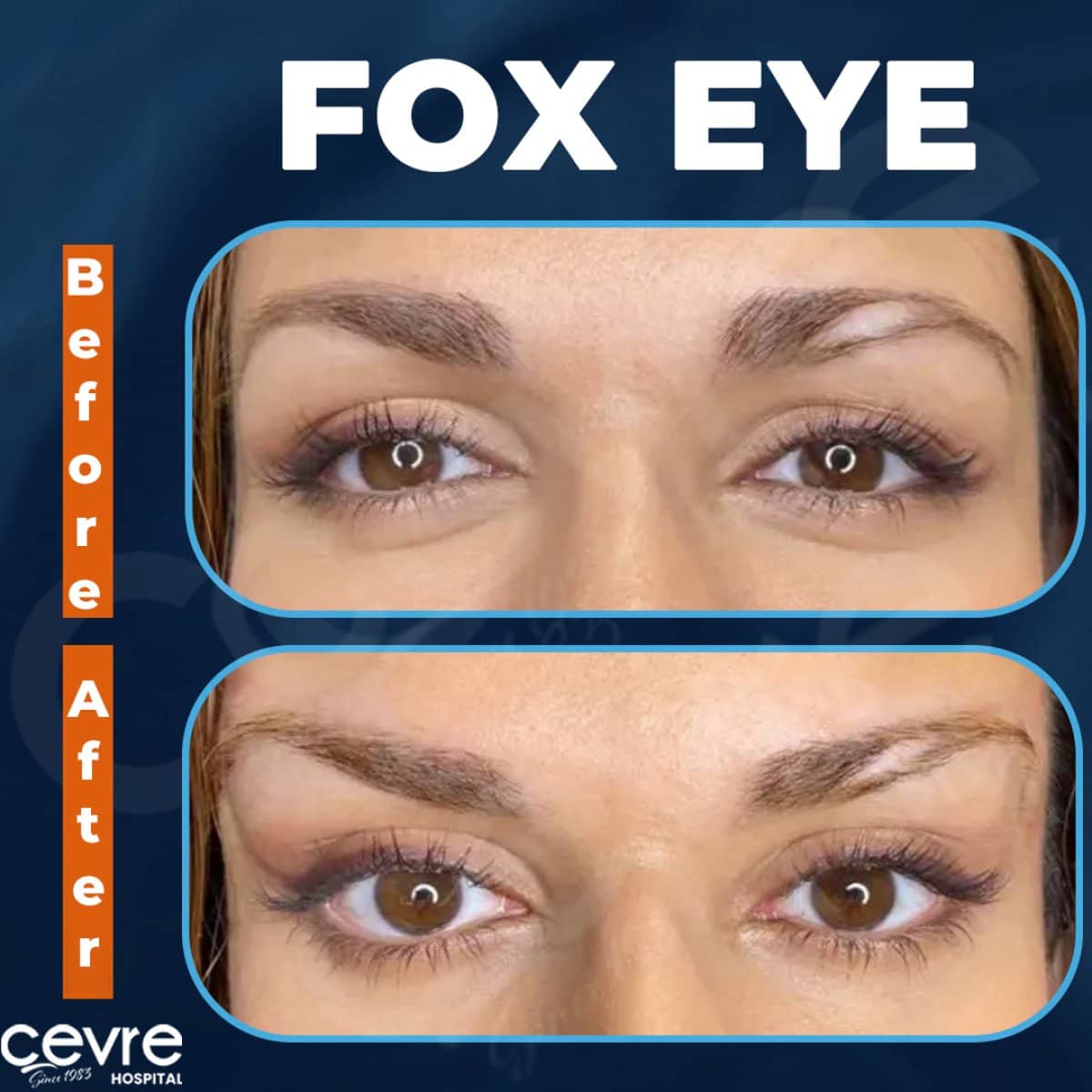 Case 15393 - fox eye surgery