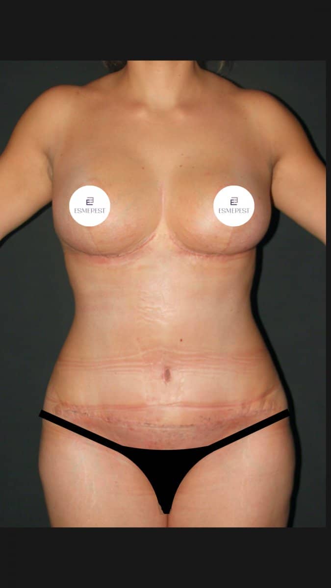 Case 15439 - before and after