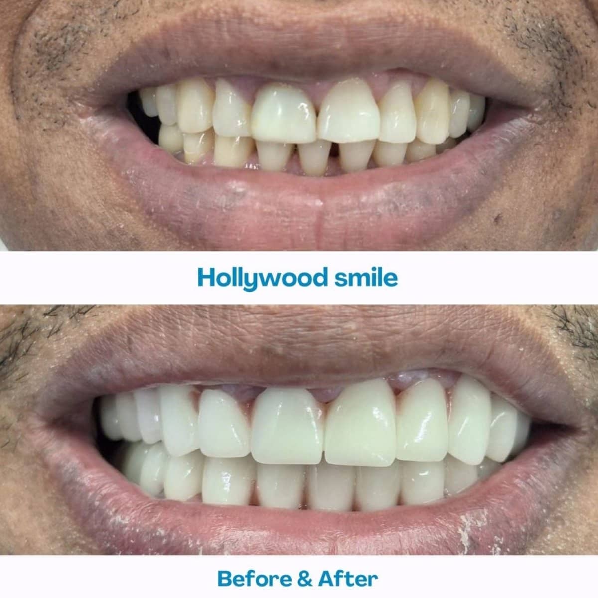 Case 15608 - Hollywood Smile