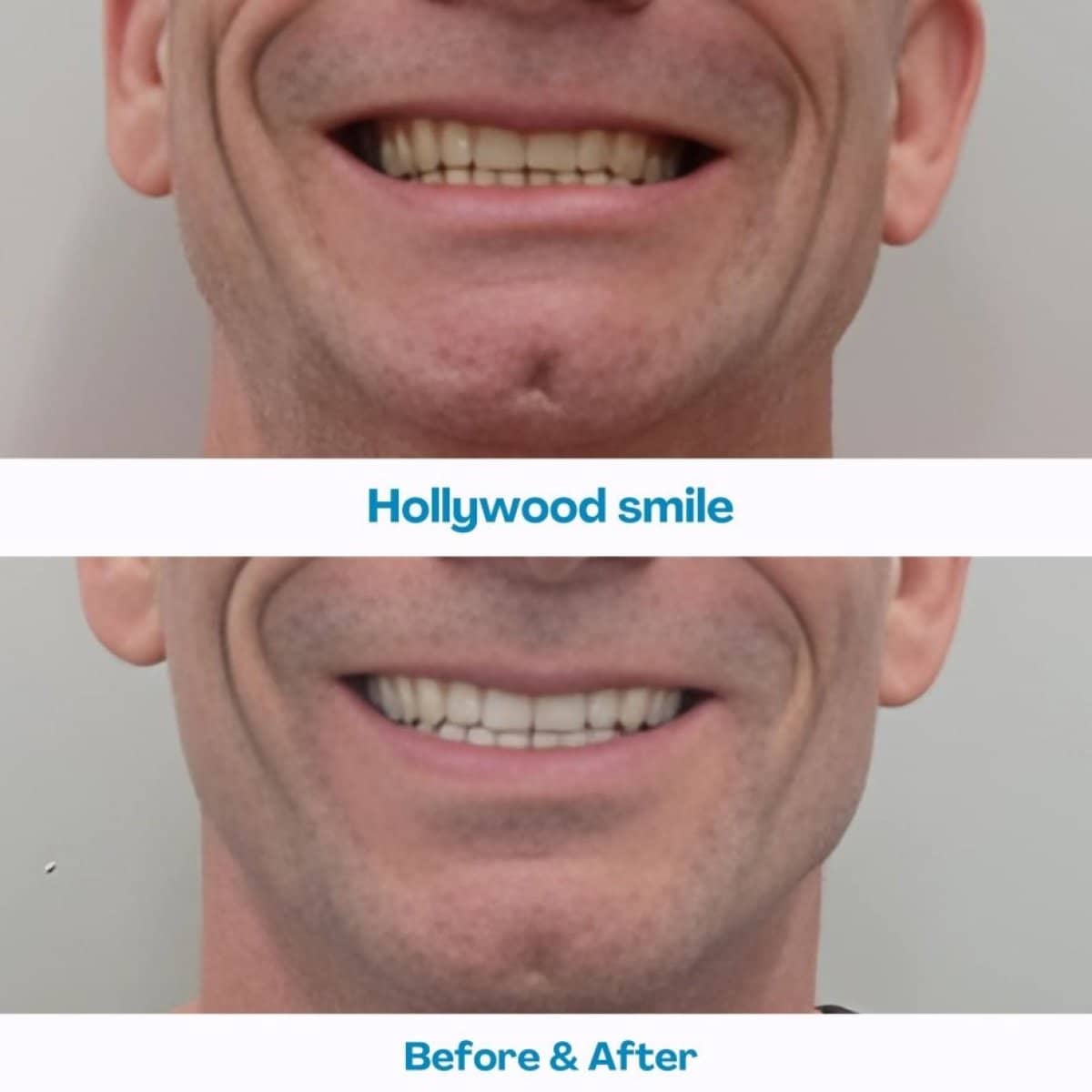 Case 15610 - Hollywood Smile