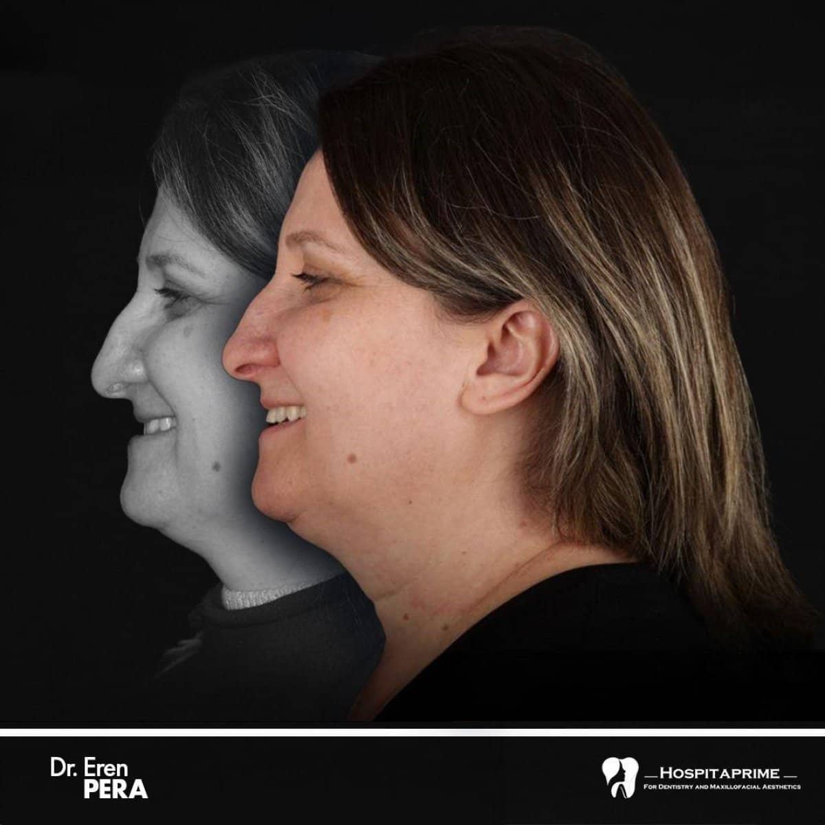Case 15727 - orthognathic surgery