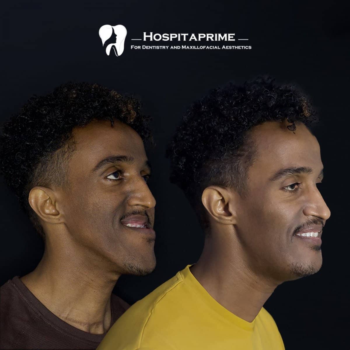 Case 15728 - orthognathic surgery