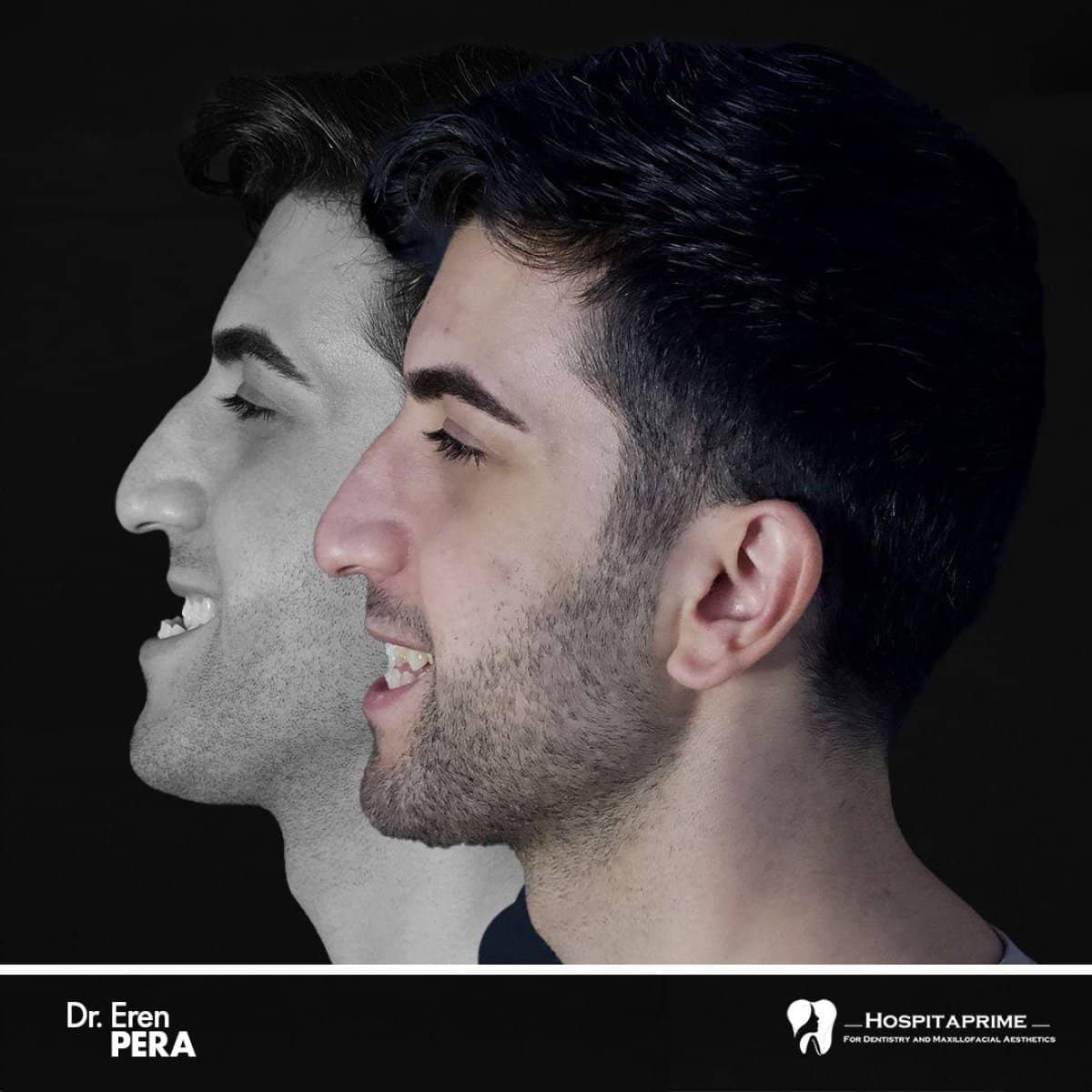 Case 15730 - orthognathic surgery