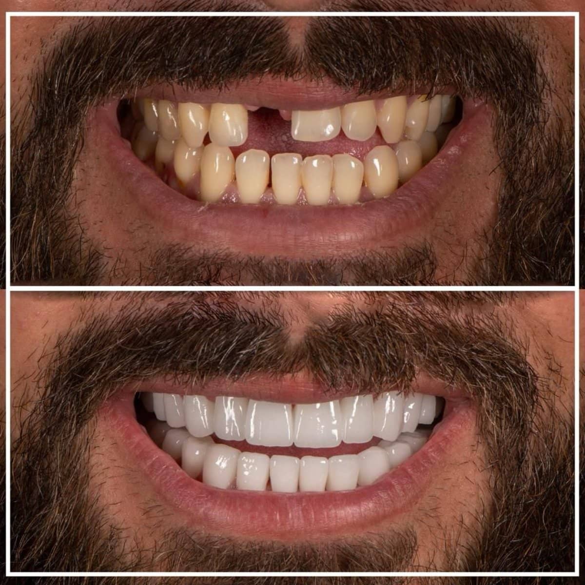 Case 15777 - tooth extraction