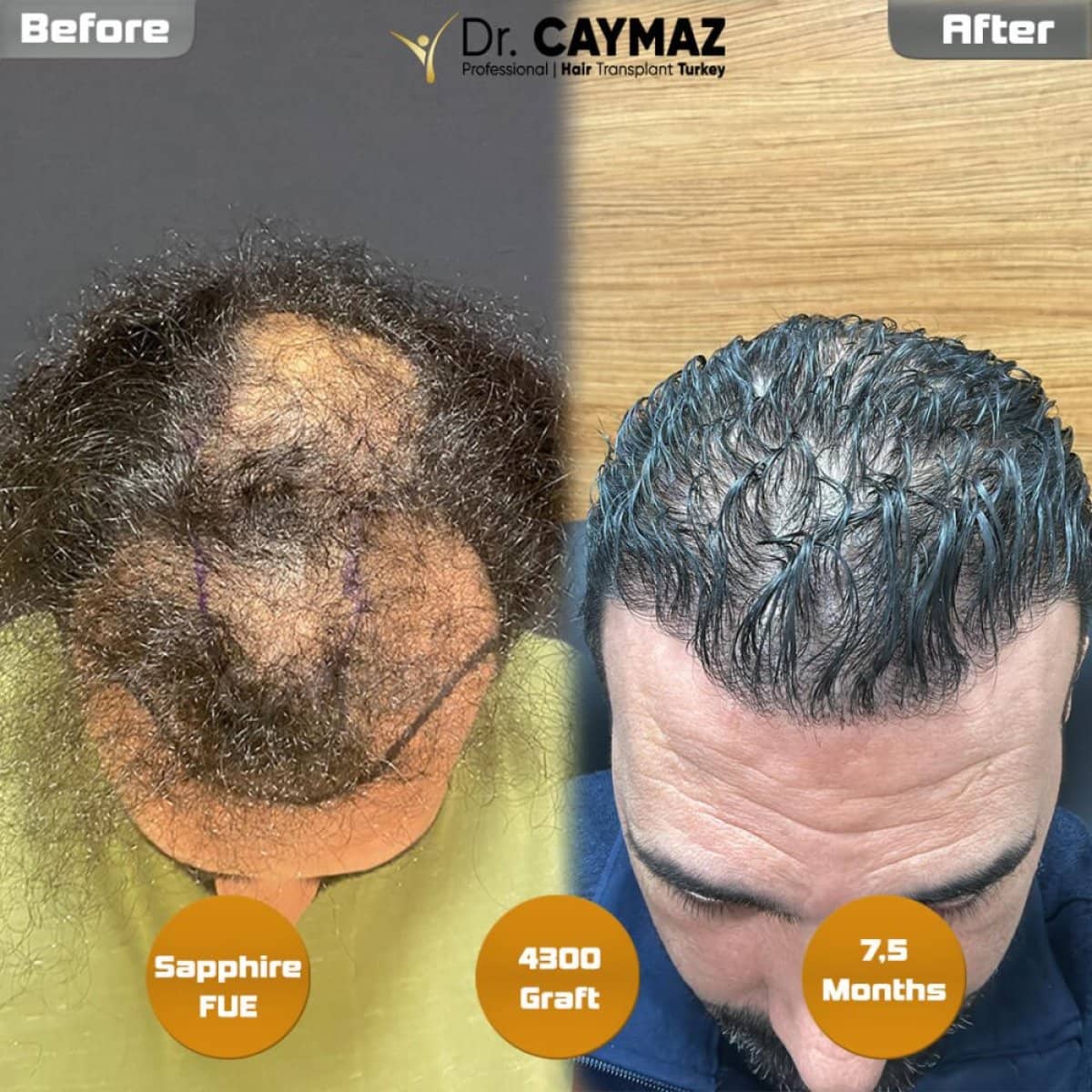 Case 15798 - before and after