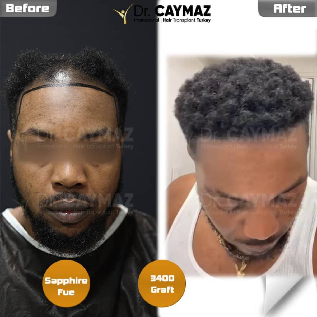 Case 15807 - before and after