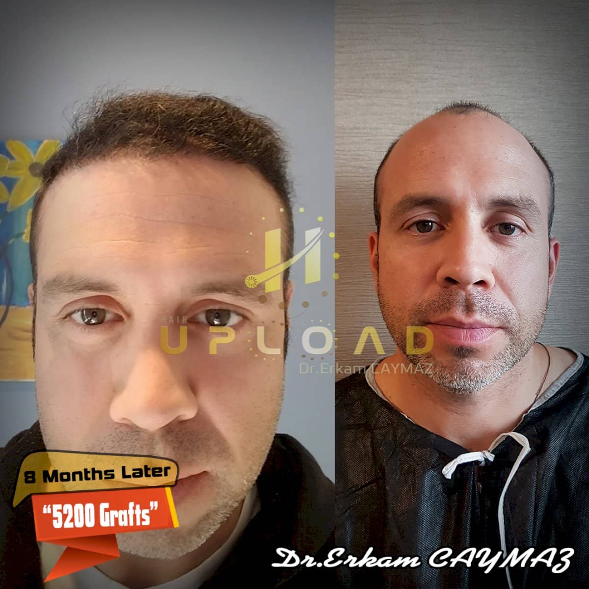 Case 15808 - before and after