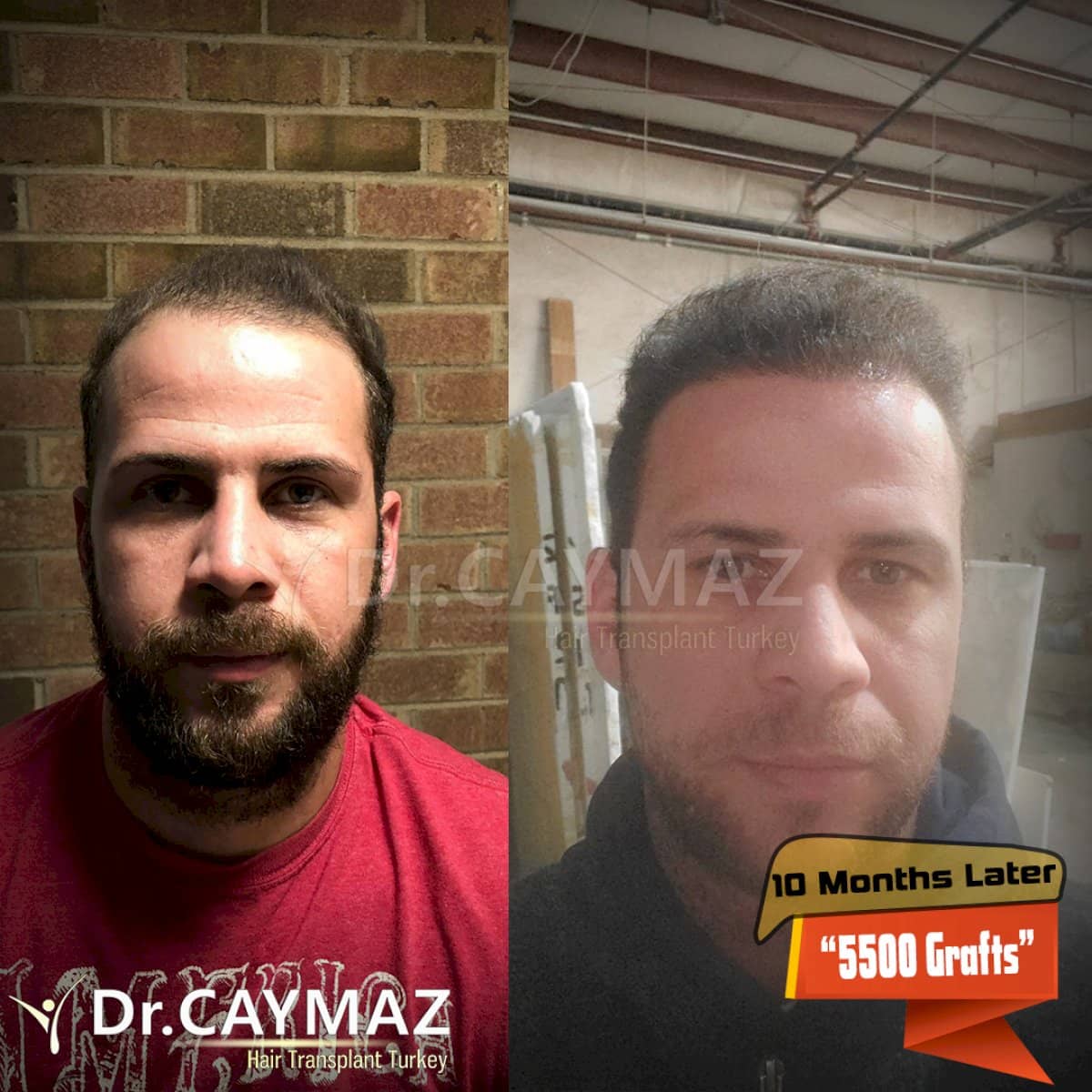 Case 15809 - result