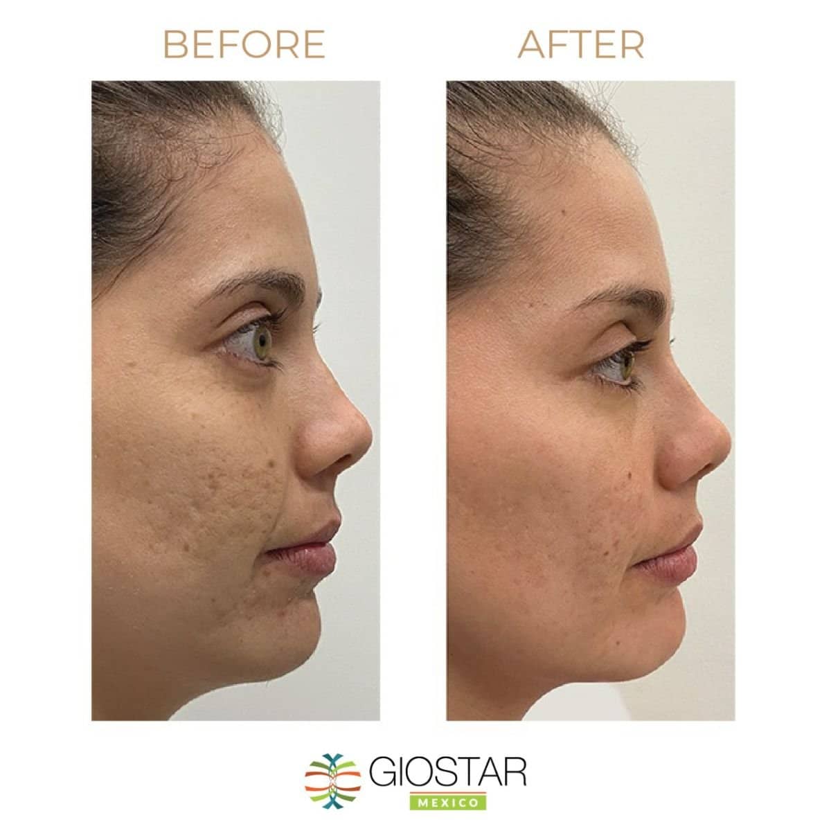 Case 15944 - stem cell therapy for facial skin rejuvenation