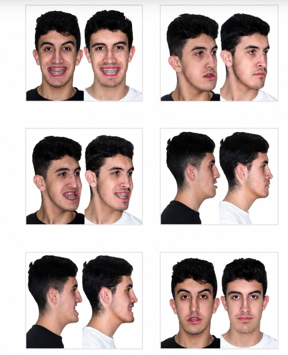Case 16086 - orthognathic surgery