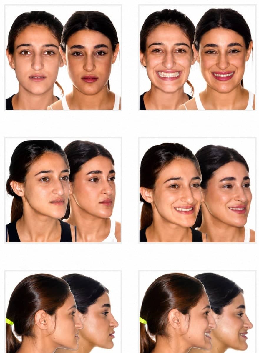Case 16093 - orthognathic surgery
