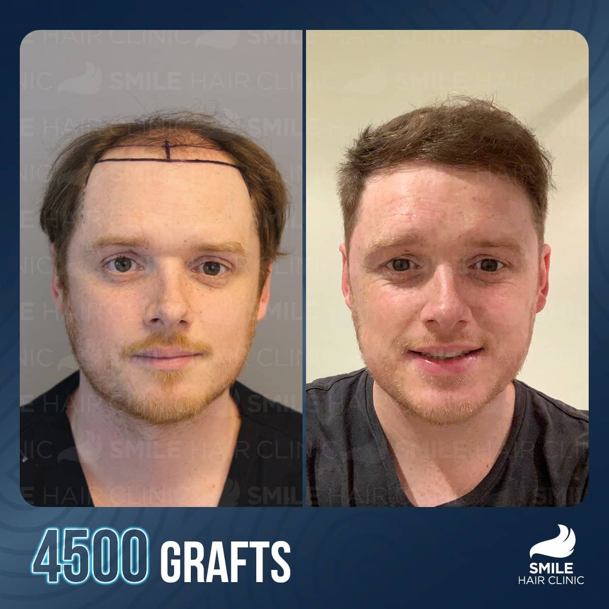 Case 16140 - result