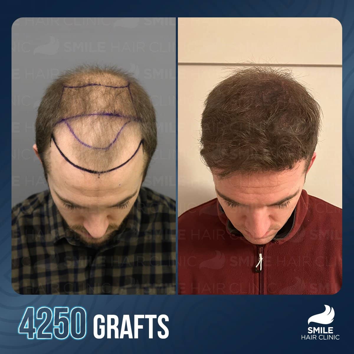 Case 16141 - result