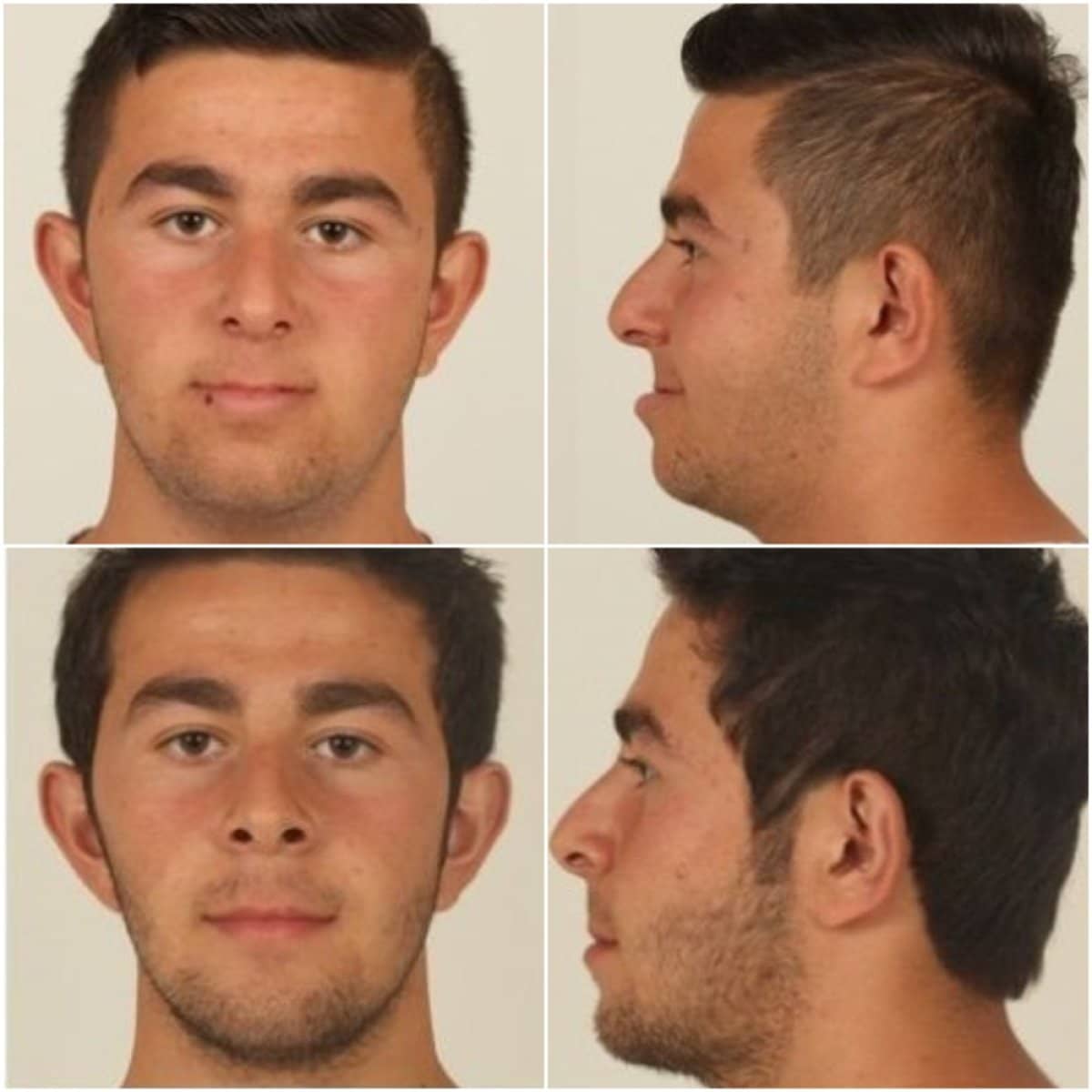 Case 16182 - jaw shaping