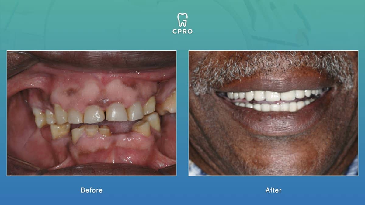 Case 16277 - dental implant