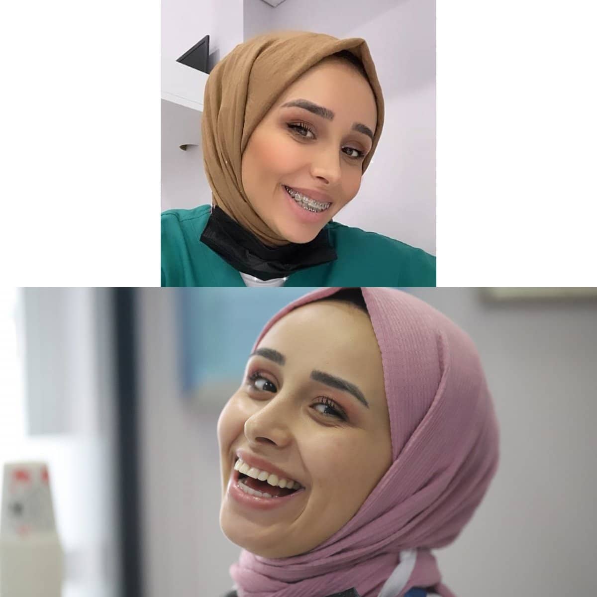 Case 16318 - orthodontic extrusion