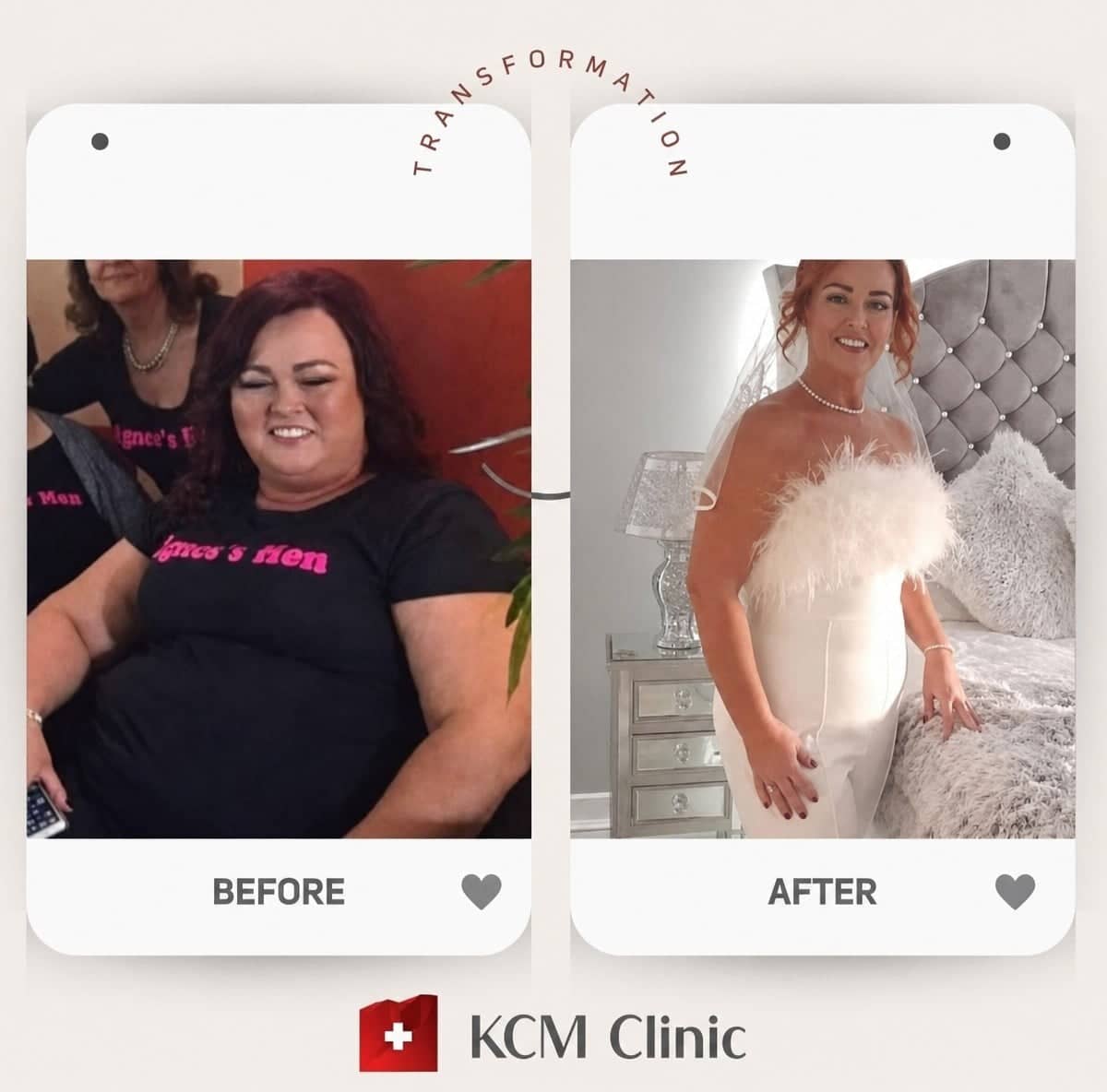 Case 16390 - gastric sleeve surgery