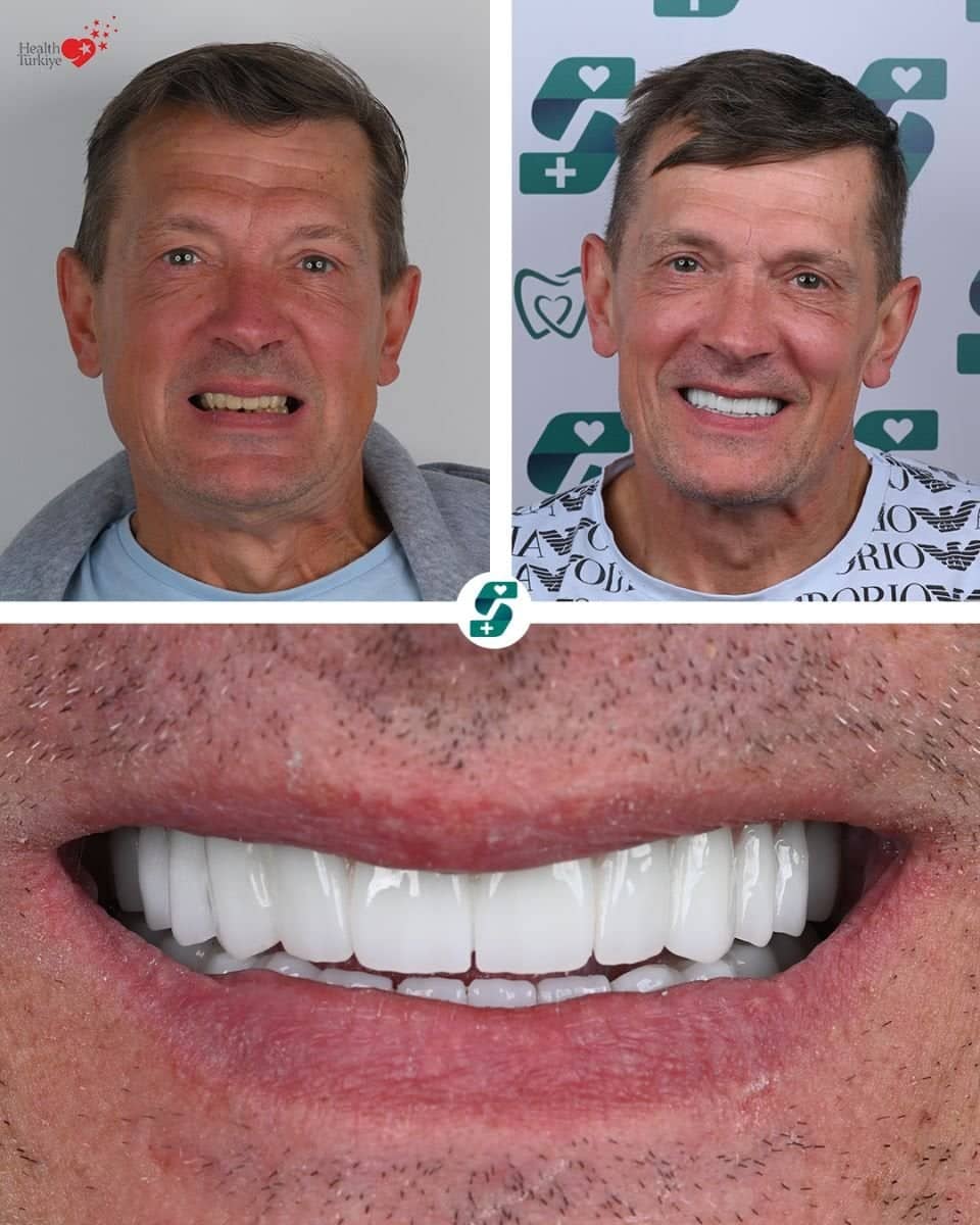 Case 16455 - dental treatment with sedation