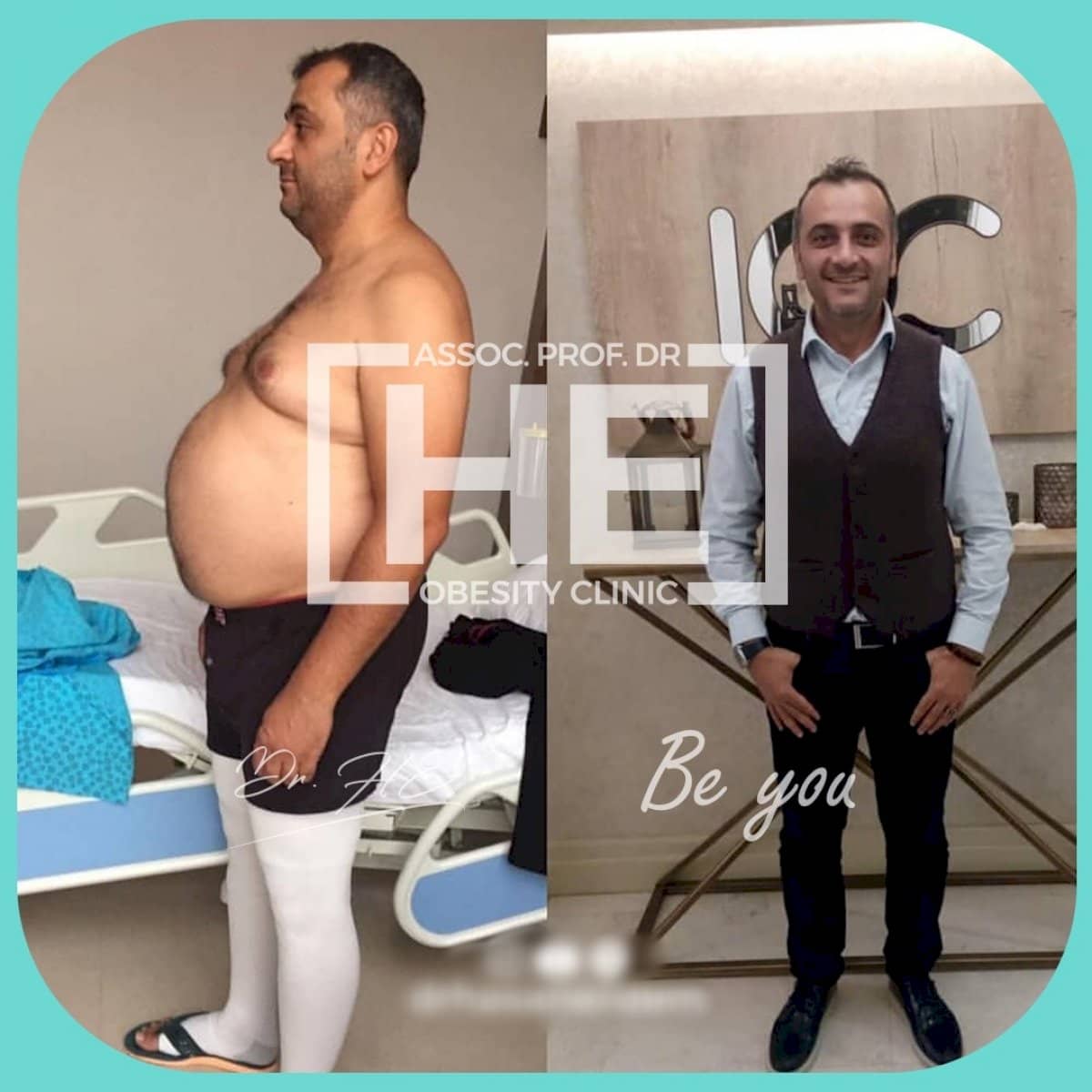 Case 16652 - gastric band