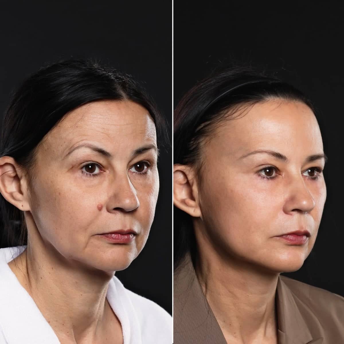 Case 17079 - before and after