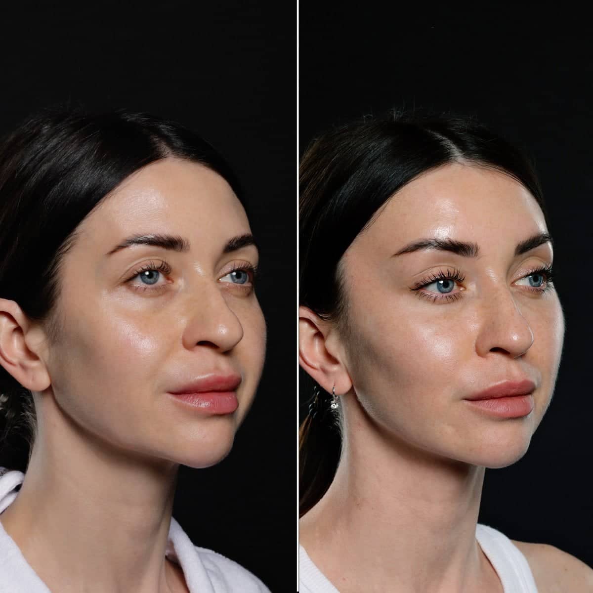 Case 17080 - before and after