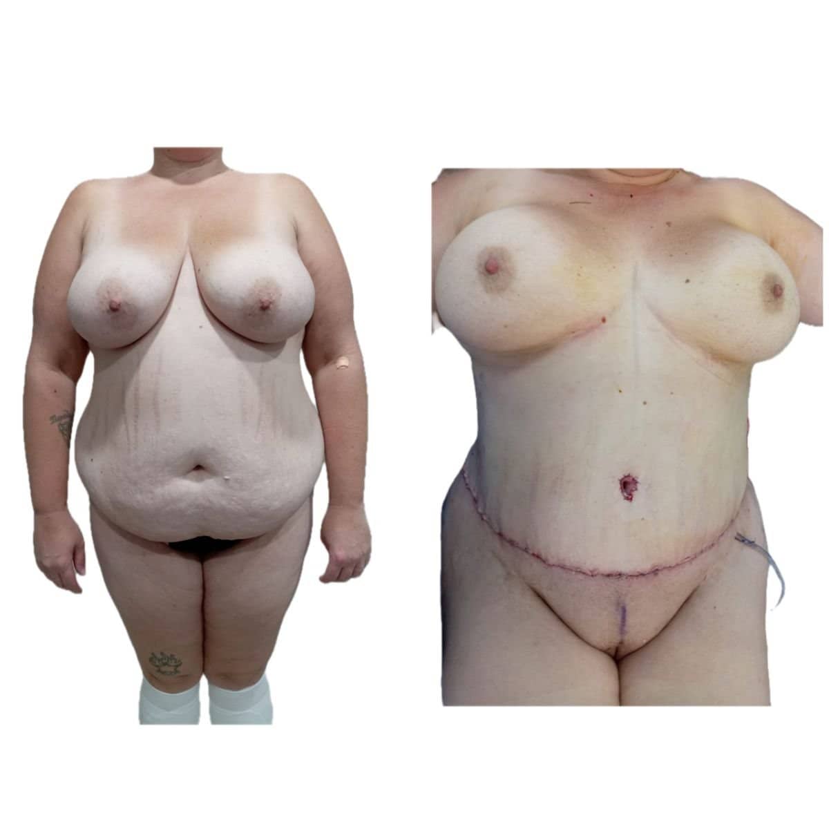 Case 17298 - results