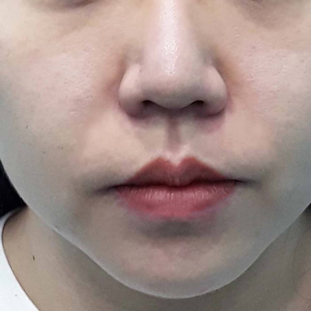 Case 17359 - before and after