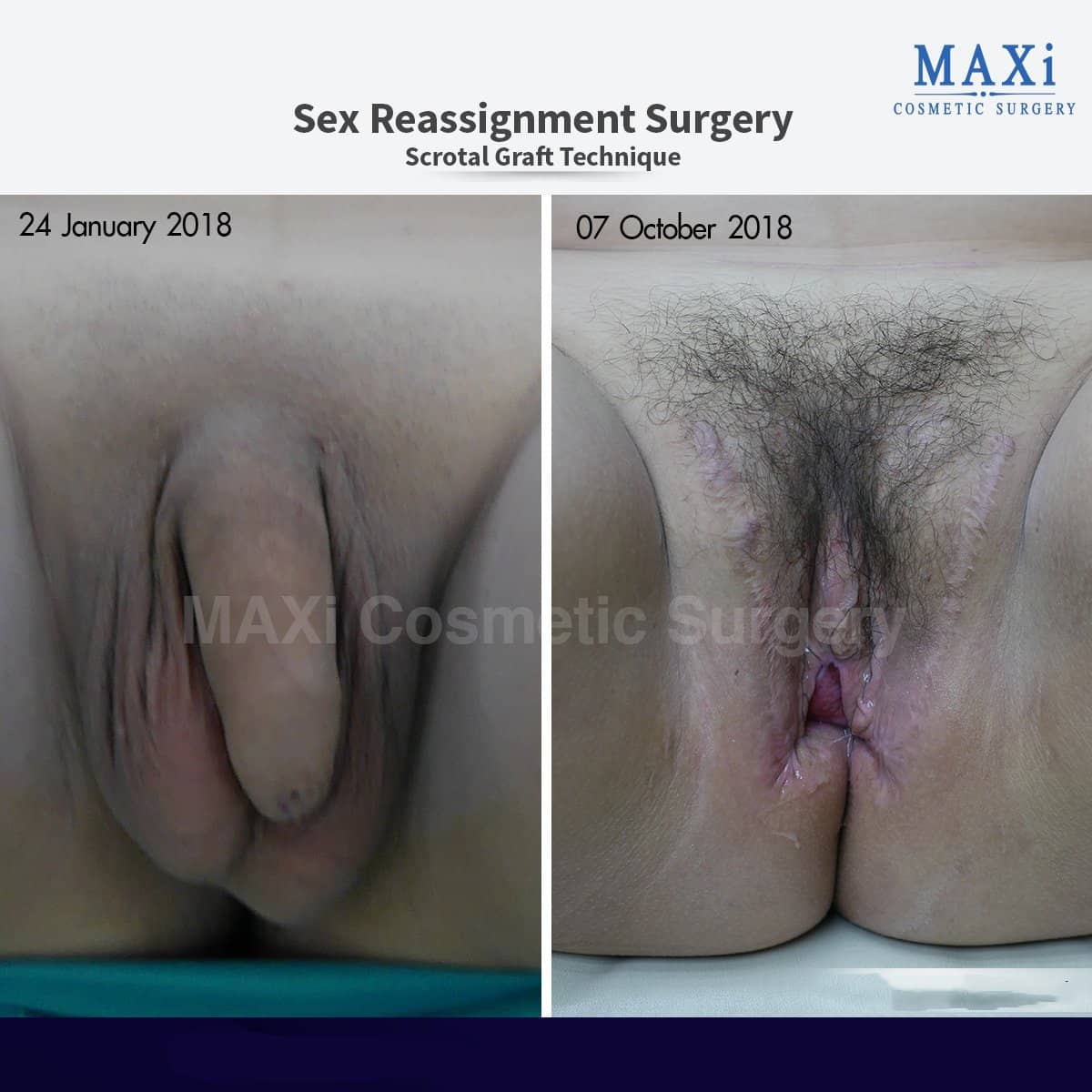 Case 17547 - results