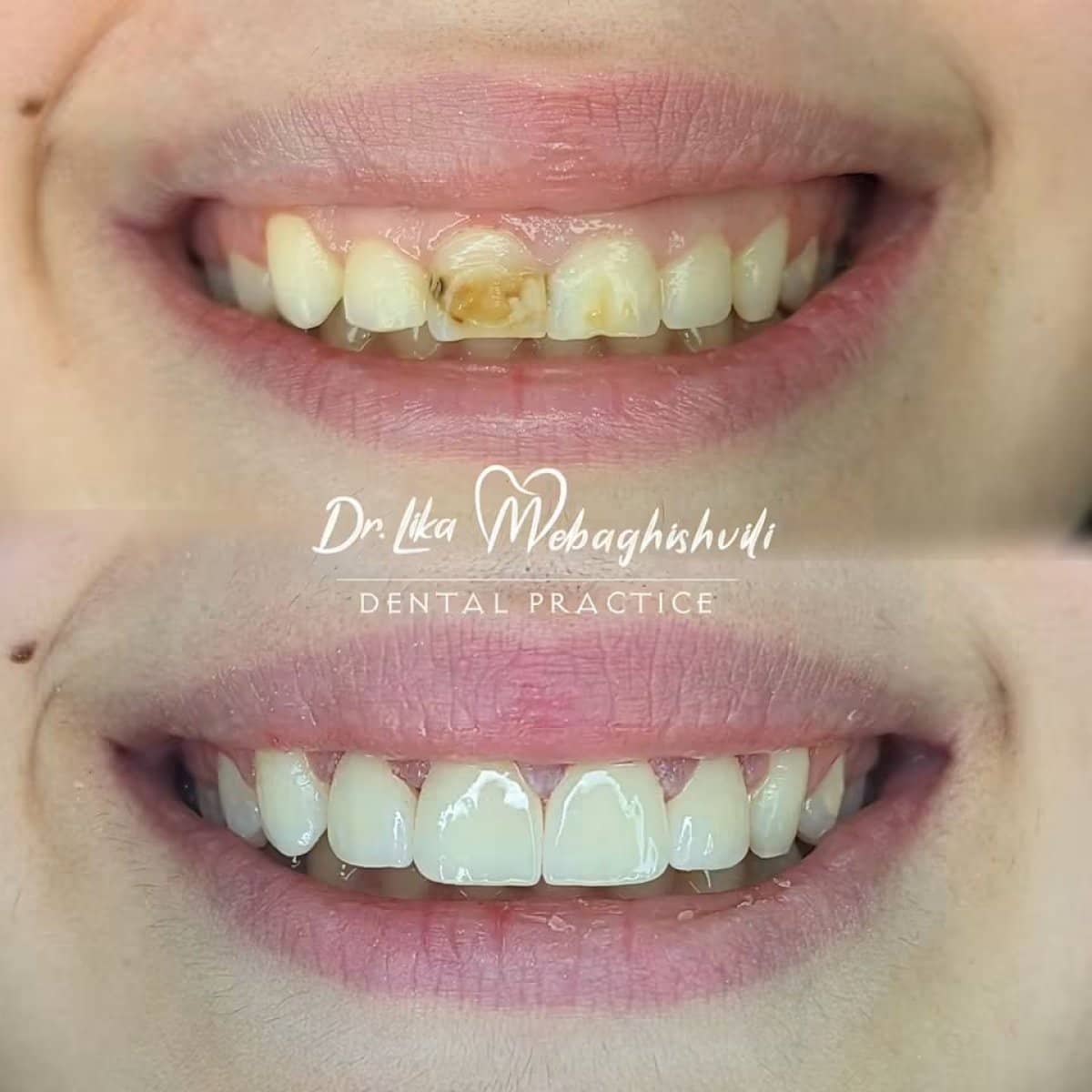 Case 17957 - dental restoration